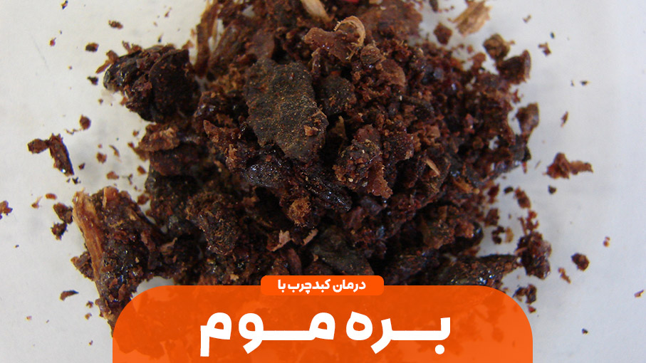 درمان کبد چرب با بره موم