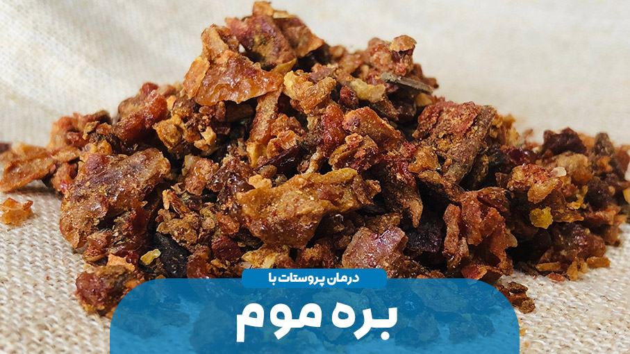 درمان پروستات با بره موم