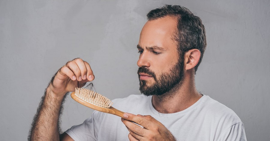 8 راهکار درمانی طبیعی برای درمان سریع ریزش موی شقیقه در زنان و مردان