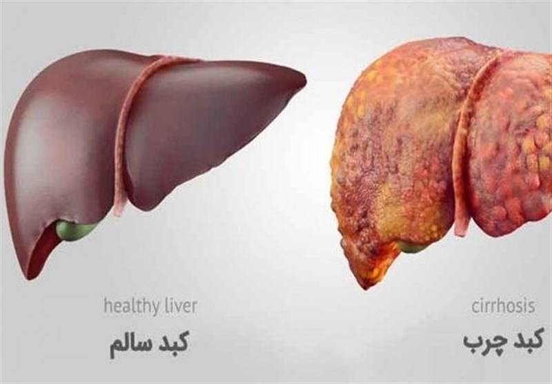 عواملی که باعث آسیب به کبد می شوند کدامند؟