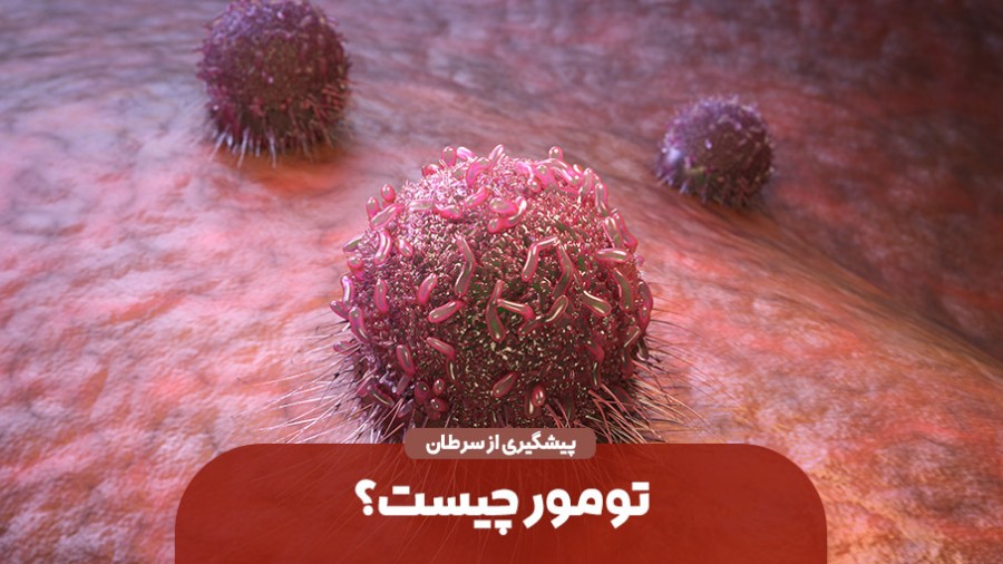 تومور چیست؟