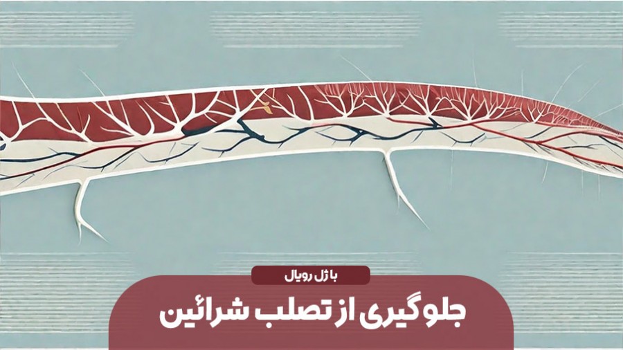 جلوگیری از تصلب شرائین