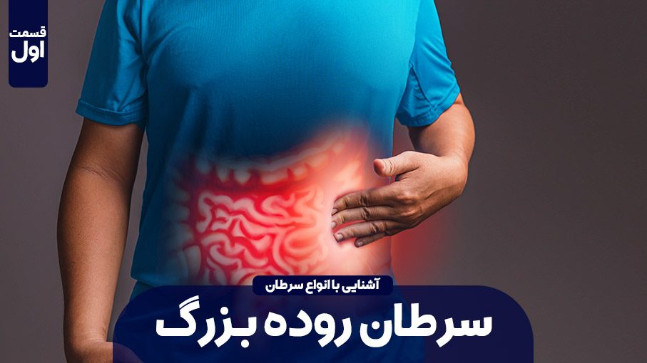سرطان روده را بشناسیم (بخش اول)