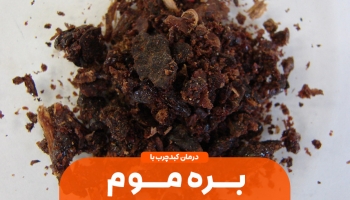 درمان کبد چرب با بره موم