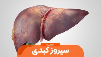 بیماری سیروز کبدی