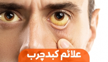 علائم بیماری های کبدی؛ نشانه‌هایی که نباید نادیده بگیرید