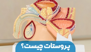 پروستات چیست؟