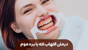 درمان التهاب لثه را به بره موم بسپارید!