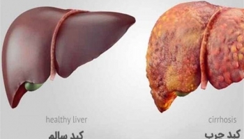 عواملی که باعث آسیب به کبد می شوند کدامند؟