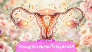 اندومتریوز و آدنومیوز از نگاه طب سنتی