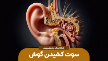 سوت کشیدن گوش؛ هشدار یک بیماری پنهان؟