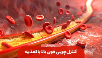 علائم چربی خون در بدن و روش‌های طبیعی کنترل آن