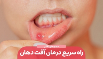 راه سریع و خانگی درمان آفت دهان