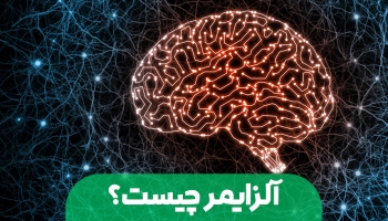 آلزایمر چیست؟