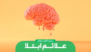 آلزایمر و علائم ابتلا