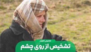 تشخیص آلزایمر از روی چشم!!