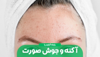 آلزایمر و رابطه آن با آکنه پوست