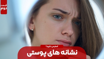 استرس و نشانه های پوستی آن! – قسمت دوم