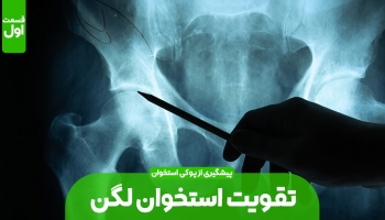 قوی کردن استخوان های لگن (بخش اول)