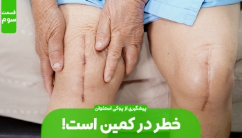 پیشگیری از مبتلا شدن به پوکی استخوان (بخش سوم)