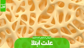 علت های پوکی استخوان (بخش اول)